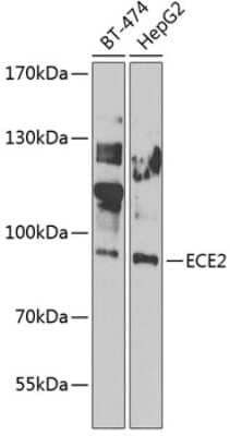 Western Blot: ECE-2 Antibody [NBP3-05677] - Western blot analysis of extracts of various cell lines, using ECE-2 antibody (NBP3-05677) at 1:1000 dilution. Secondary antibody: HRP Goat Anti-Rabbit IgG (H+L) at 1:10000 dilution. Lysates/proteins: 25ug per lane. Blocking buffer: 3% nonfat dry milk in TBST. Detection: ECL Enhanced Kit. Exposure time: 30s.